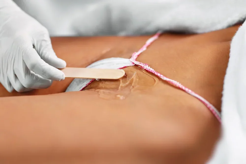 Depilacion Laser Temploestetic