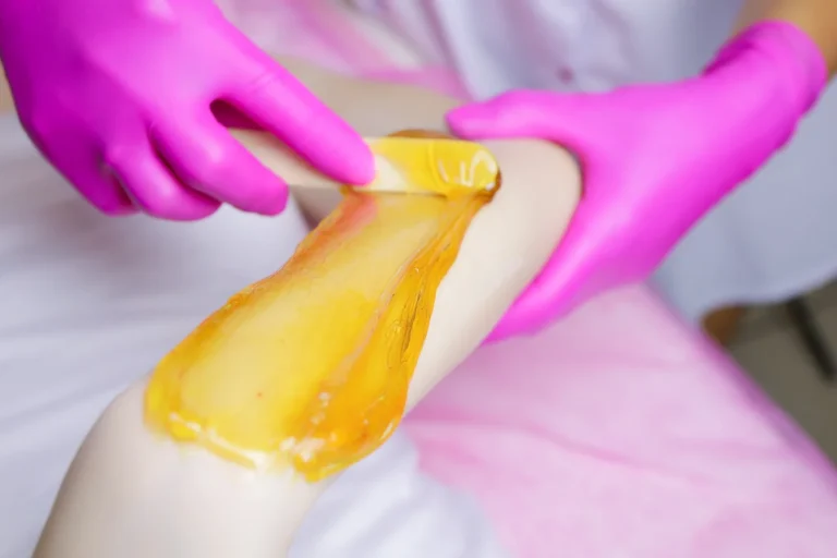 Depilacion con cera Temploestetic