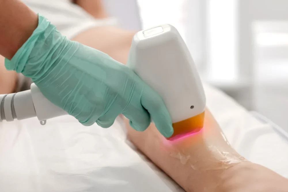 Depilacion Laser Temploestetic