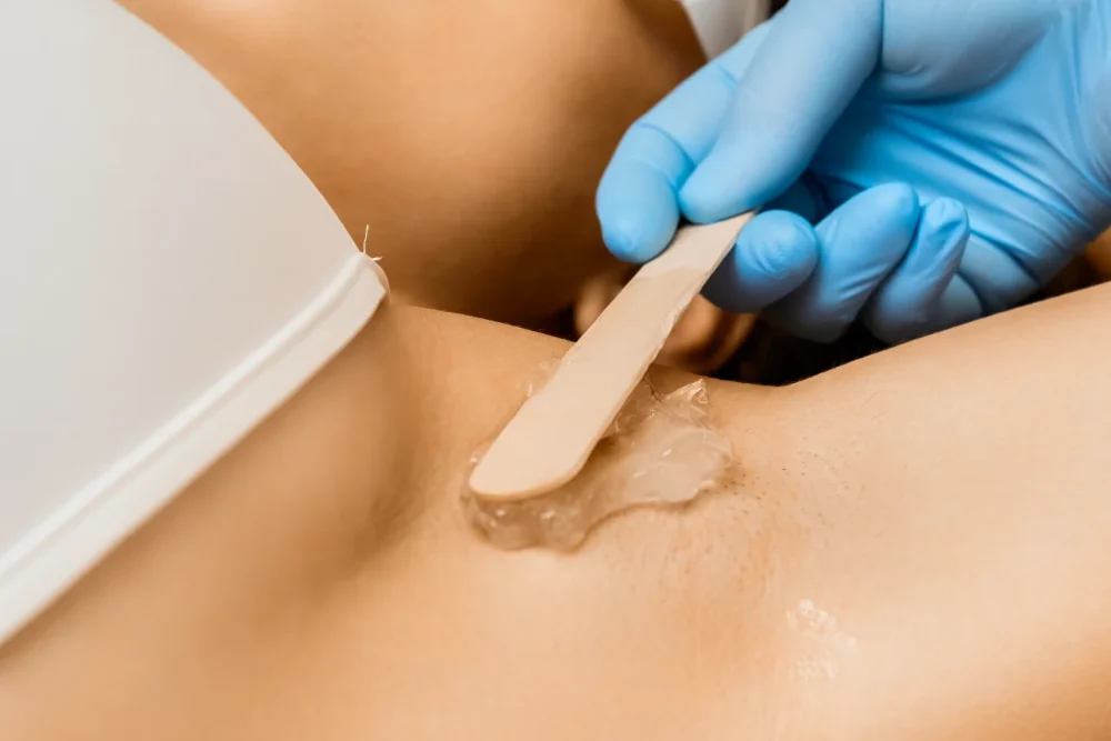 Depilacion con cera Temploestetic